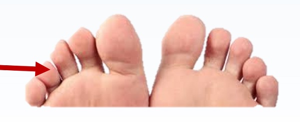 Toe